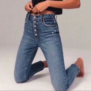 Abercrombie and Fitch | Simone High Rise Ankle Exposed Button Fly 6/28